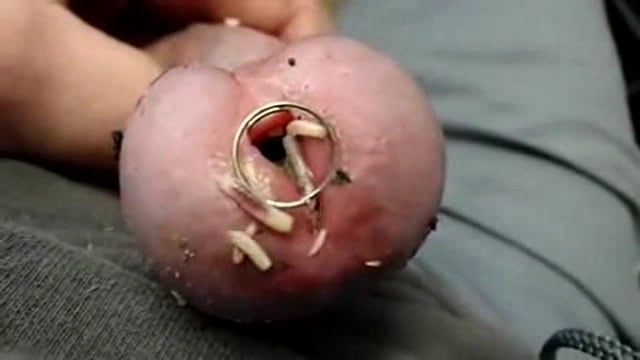Maggots Inside Of Penis 3541